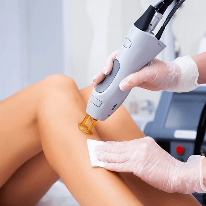 Laser Hair Removal