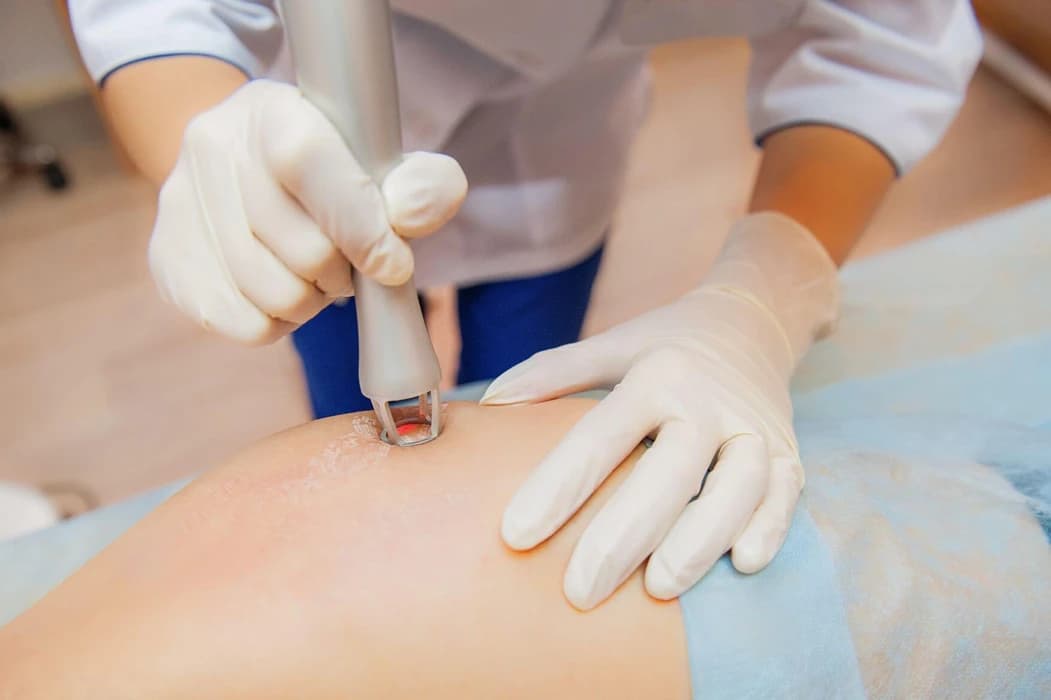 Stretch Marks, Cellulite Reduction & Body Contouring